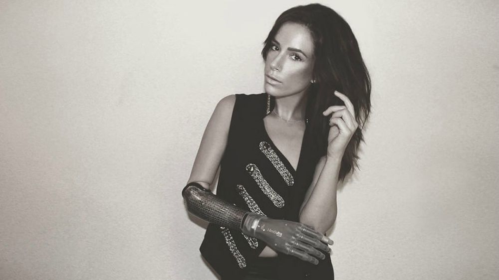 Rebekah Marine: Το μοντέλο με το βιονικό πρόσθετο χέρι θα περπατήσει στην Εβδομάδα Μόδας της Νέας Υόρκης