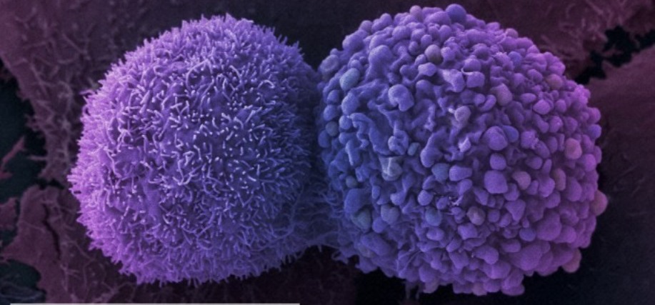 Τα 116 πράγματα που προκαλούν καρκίνο