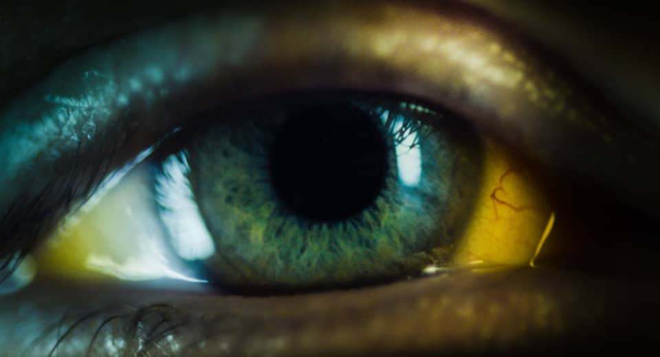 Το φαινόμενο Nocebo: Όταν προκαλείς την μοίρα σου