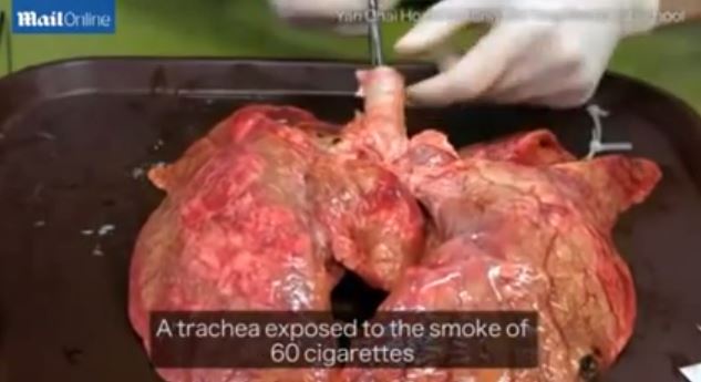 Τι κάνει το τσιγάρο στους πνεύμονες μας