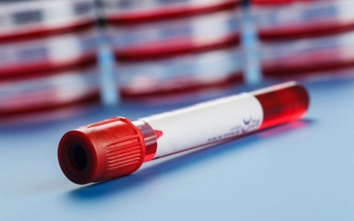 Πώς θα καταλάβετε ότι ο αιματοκρίτης σας είναι κάτω από τα όρια;