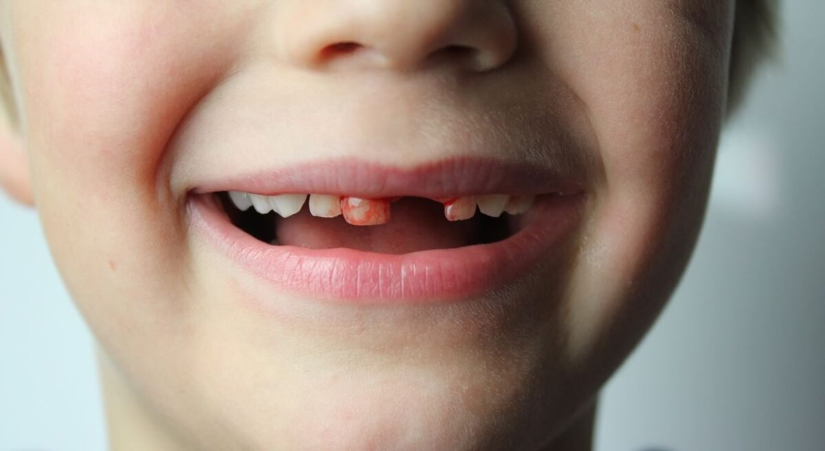 Γιατί οι γονείς δεν πρέπει να πετάνε τα παιδικά δόντια