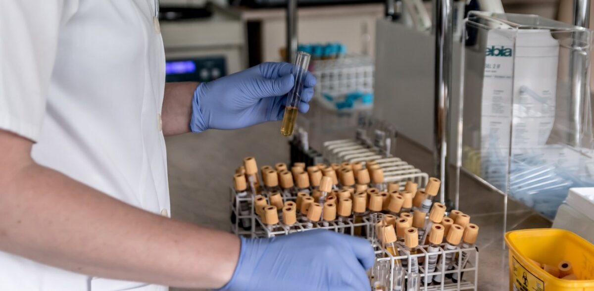 Κλειστά τα διαγνωστικά κέντρα όλης της χώρας από σήμερα