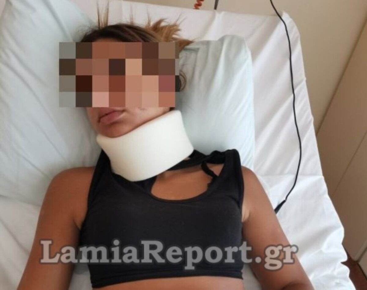 Η 13χρονη που έπεσε θύμα άγριου ξυλοδαρμού από 17χρονες - Όλα όσα είπαν οι γονείς της