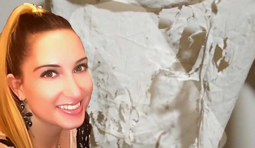 Iωάννα Παλιοσπύρου | Σοκαριστικές εικόνες με τα λιωμένα ρούχα της μετά την επίθεση