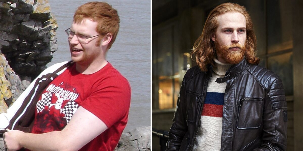 Gwilym Pugh | Η απίστευτη μεταμόρφωση του μοντέλου που κατέκτησε τις πασαρέλες κι ήταν κάποτε 140 κιλά